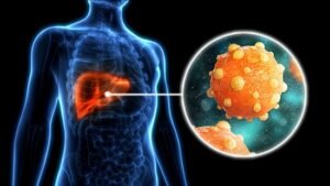 Putuskan Penularan, Wujudkan Indonesia Bebas Hepatitis 2030